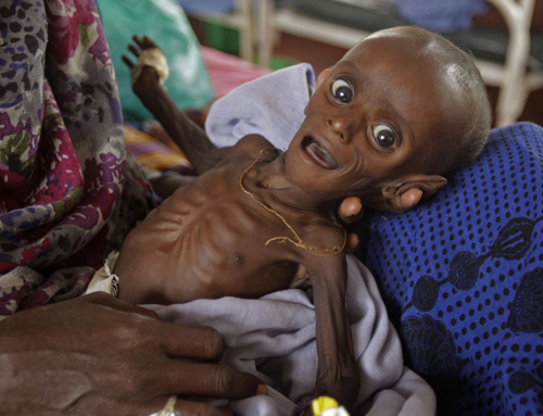 Nạn đói khủng khiếp ở Somalia ảnh 4