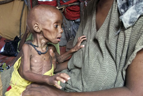 Nạn đói khủng khiếp ở Somalia ảnh 7