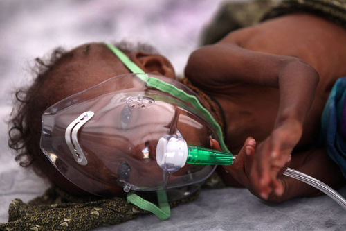 Nạn đói khủng khiếp ở Somalia ảnh 12