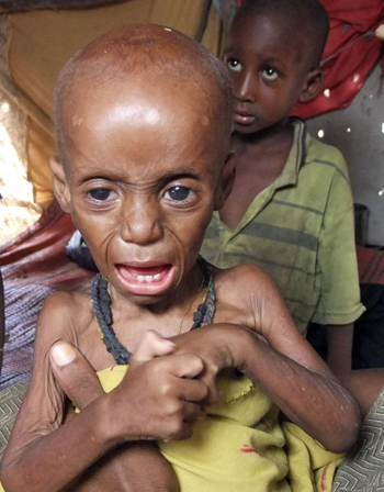 Nạn đói khủng khiếp ở Somalia ảnh 13