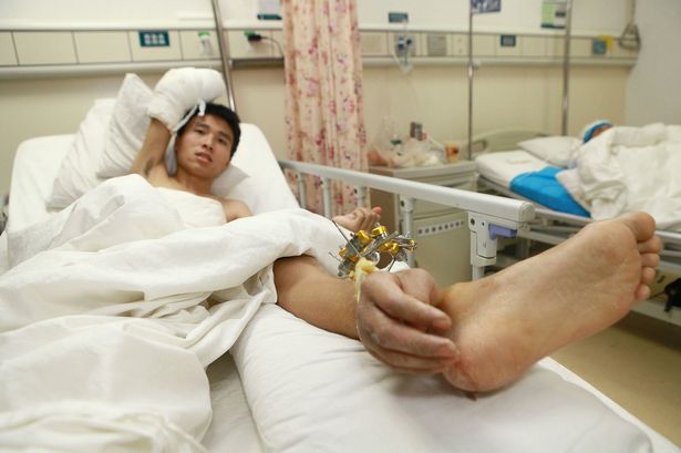 Kỳ lạ gắn tay vào chân ảnh 2