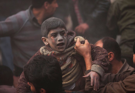 Những nạn nhân bé nhỏ trong nội chiến Syria ảnh 3