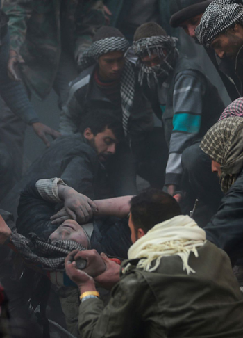 Những nạn nhân bé nhỏ trong nội chiến Syria ảnh 7