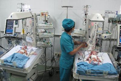 Phẫu thuật thành công cặp song sinh dính liền ảnh 1
