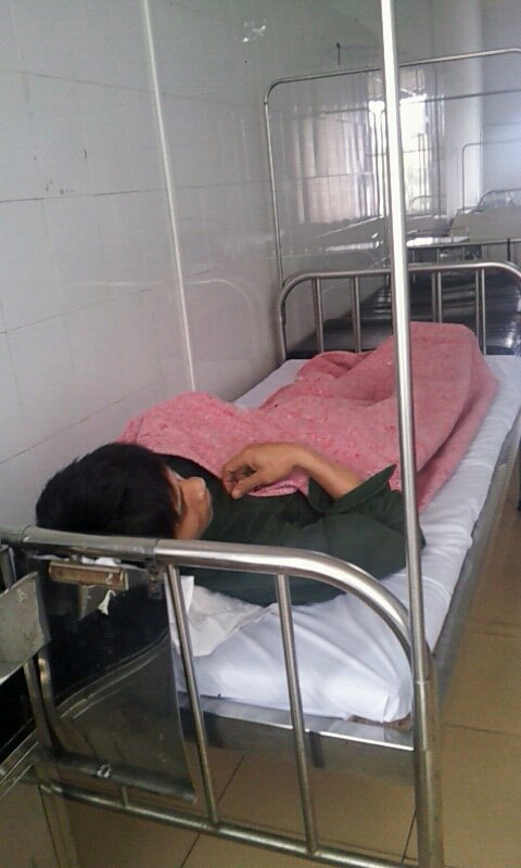 Bị thanh sắt văng vào người, hai công nhân nguy kịch ảnh 1
