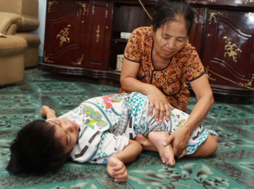 Chiến tranh phi nghĩa và hậu quả nặng nề từ chất độc da cam/điôxin ảnh 1