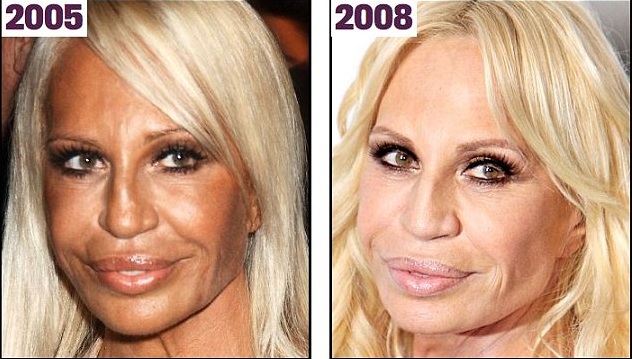 'Nữ hoàng' Versace gây sốc với bộ mặt biến dạng ảnh 4