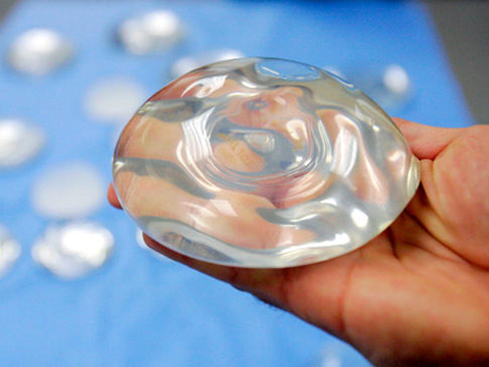Phát hiện ung thư vú do nâng ngực bằng silicone ảnh 1