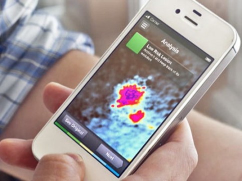Chẩn đoán ung thư nhanh qua smartphone ảnh 1