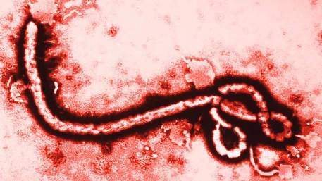 Tìm ra 'gót chân Achilles' của virus Ebola ảnh 1