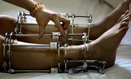 Thế giới ngầm kéo dài chân ở Ấn Độ ảnh 1