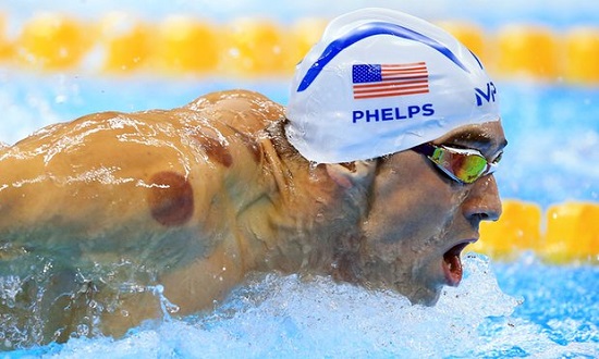 Cơ thể đầy vết bầm giác hơi của hàng loạt VĐV Olympic ảnh 2