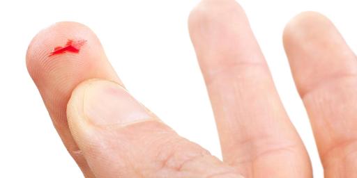 Tại sao giấy cắt vào tay lại đau đến thế? ảnh 1