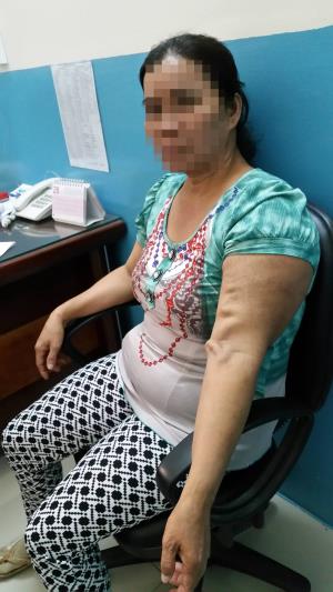 Người phụ nữ hơn 40 năm sống chung với mảnh đạn ảnh 1