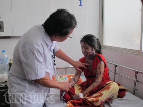 Dịch bệnh thủy đậu đang vào mùa ảnh 1