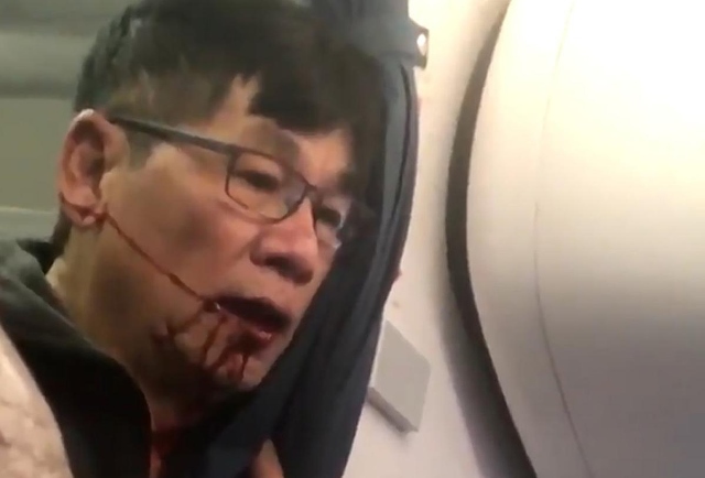 United Airlines 'trắng án' vụ hành khách gốc Việt bị đấm chảy máu mồm ảnh 1