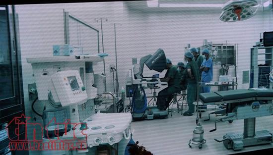 Bệnh viện Chợ Rẫy áp dụng phẫu thuật nội soi bằng robot ảnh 1